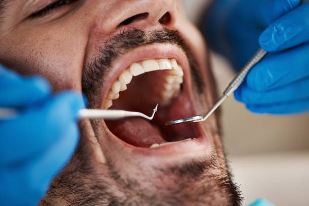 Best Broken or Cracked Tooth Emergency Dentist in Vernal, UT